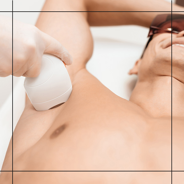 Side 2 man getting laser hair removal